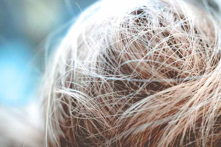 Causes of White Hair and Natural Prevention Methods